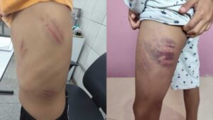 INVESTIGAÇÃO INOCENTA MÃE E FILHO ACUSADOS DE AGREDIR ESTUDANTE AUTISTA EM CAMPO GRANDE
